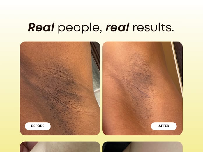 Dark Spot Exfoliating Scrub- Bermuda